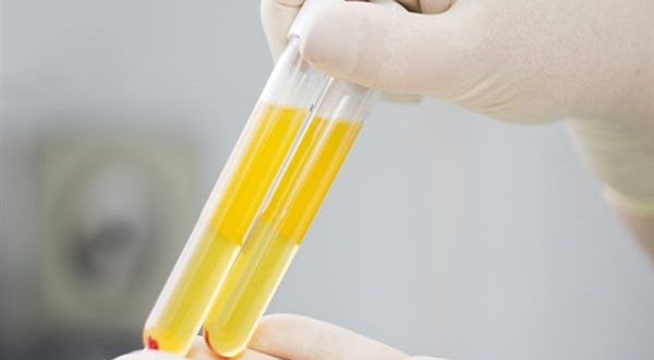 مليون جنيه عقوبة إدارة مركز تجميع بلازما الدم دون ترخيص